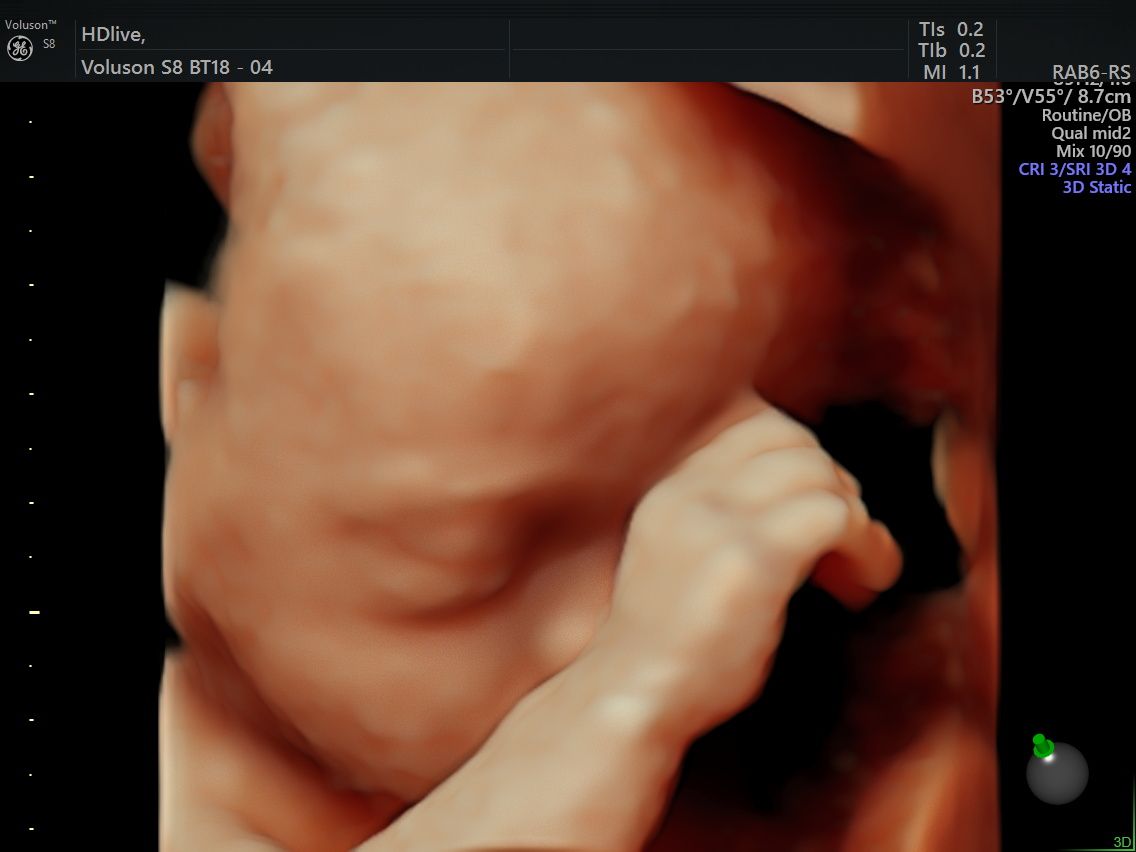 Carlos Lenin Rodriguez Mora-5