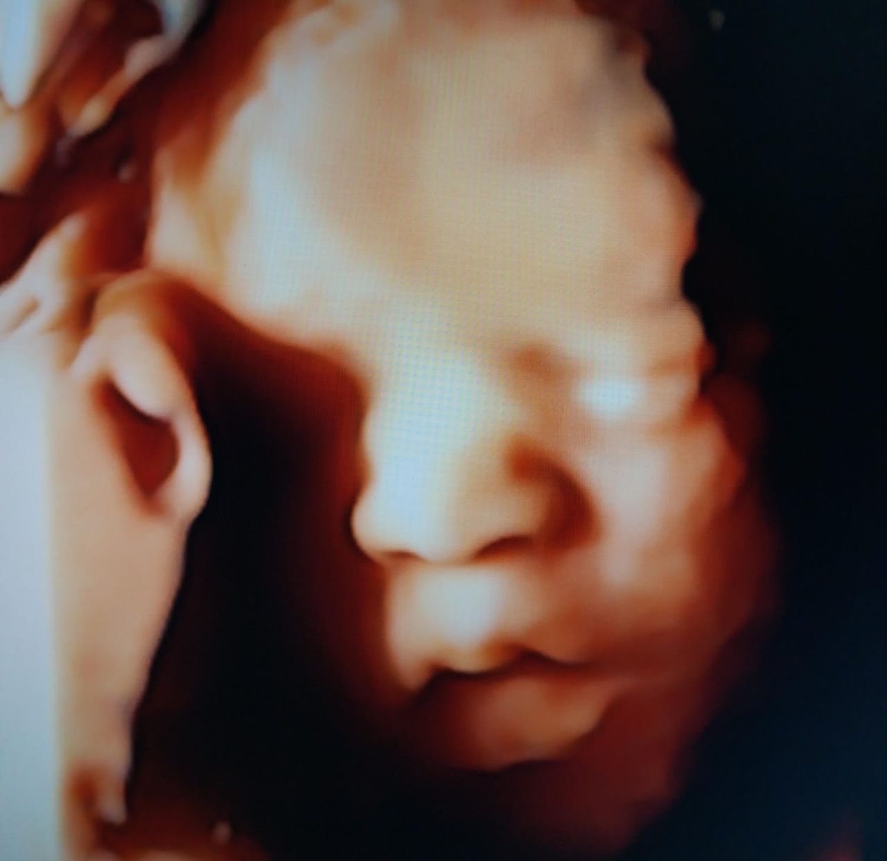 Iván André Guzmán Amador-0