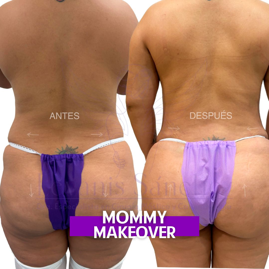 Leyanis Sánchez Hidalgo-3