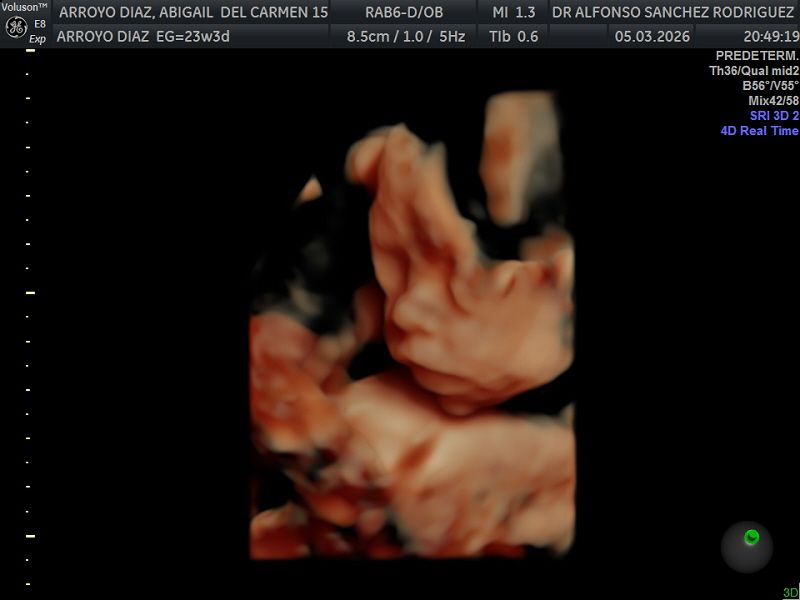 Alfonso Sanchez Rodriguez-58