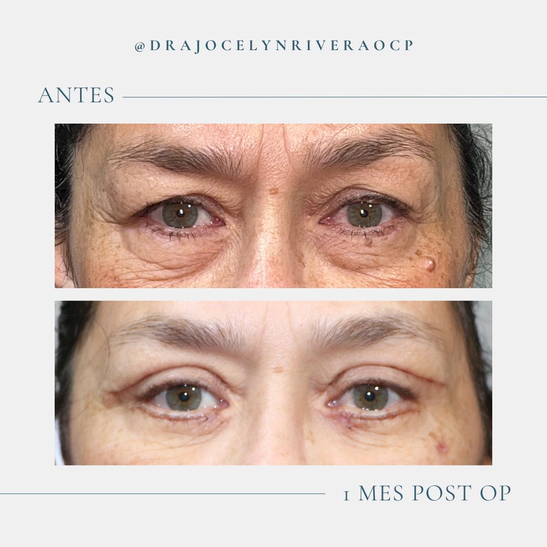 Ivonne Jocelyn Rivera Alvarado-1