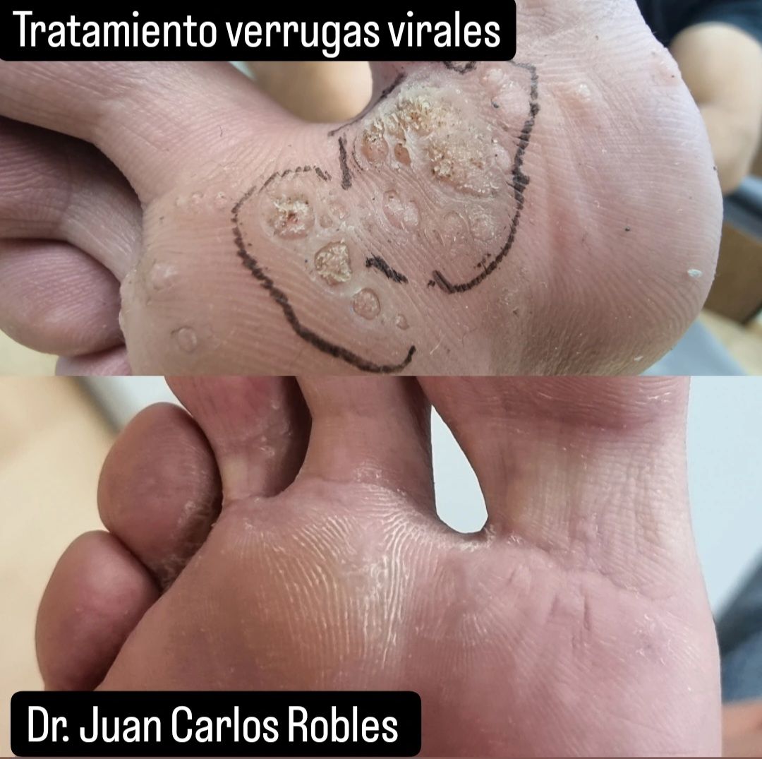 Juan Carlos Robles Méndez-16