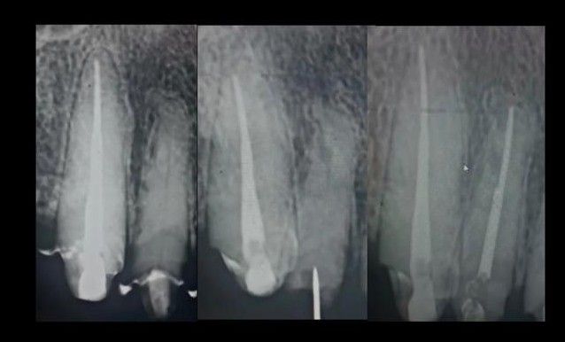 María De Lourdes Aquino Quinto-1