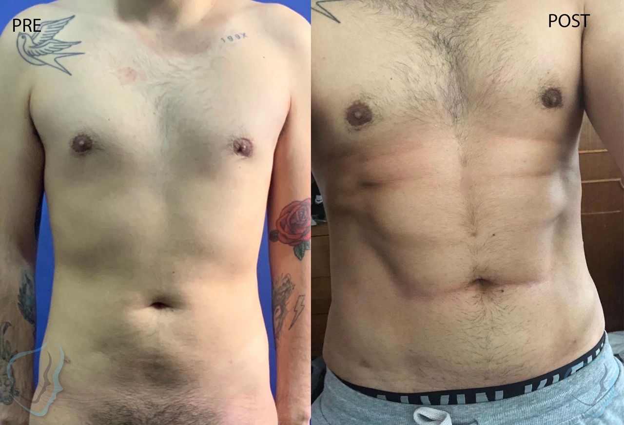 Giuseppe Tanzillo-37