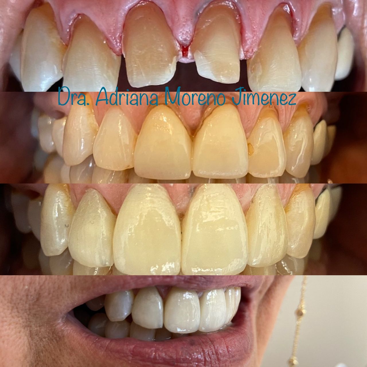 Adriana Moreno Jimenez-16