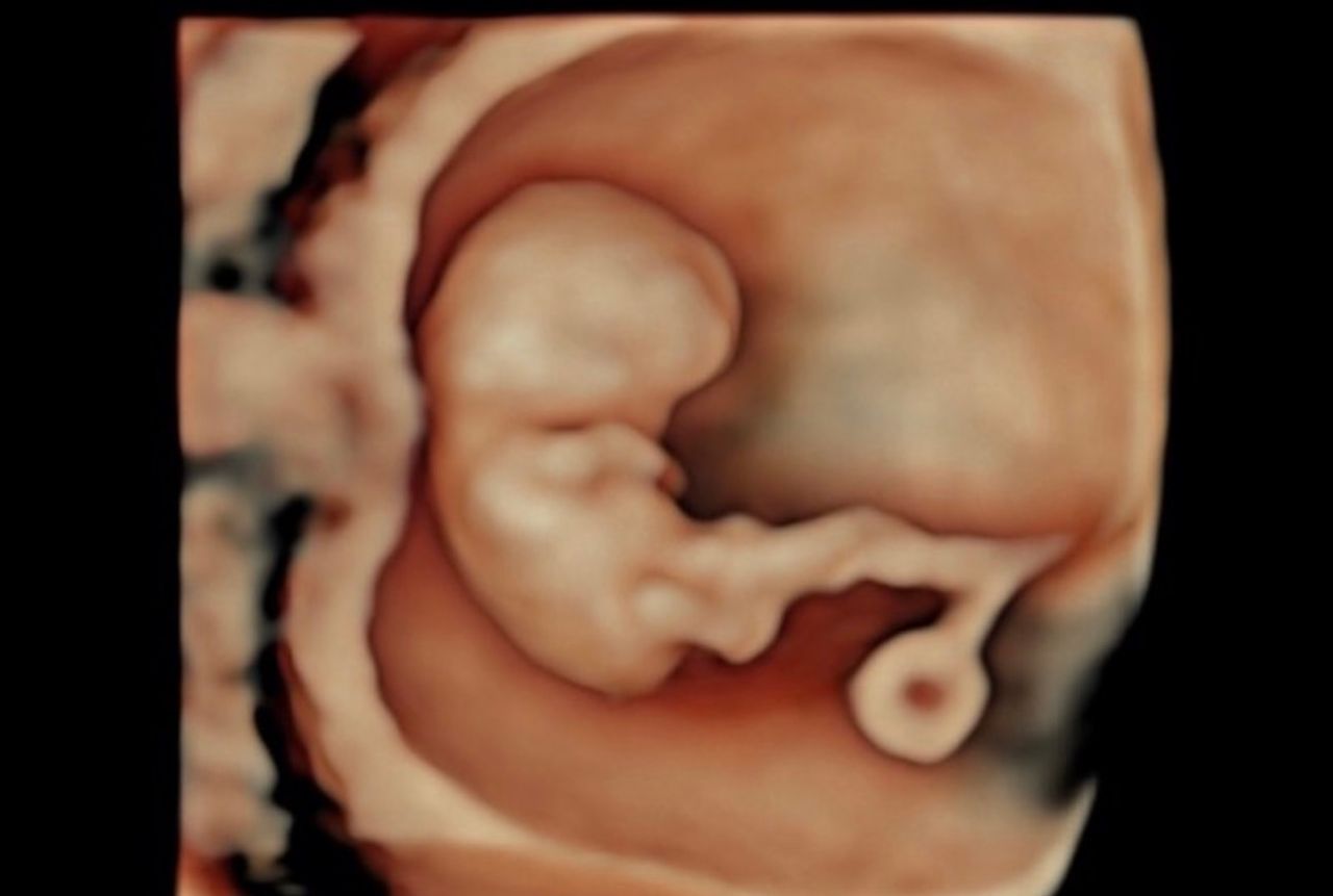 María Teresa Flores Molina-19