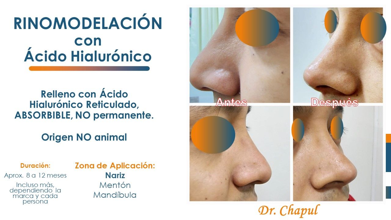 José Luis Muñoz Chapul-3