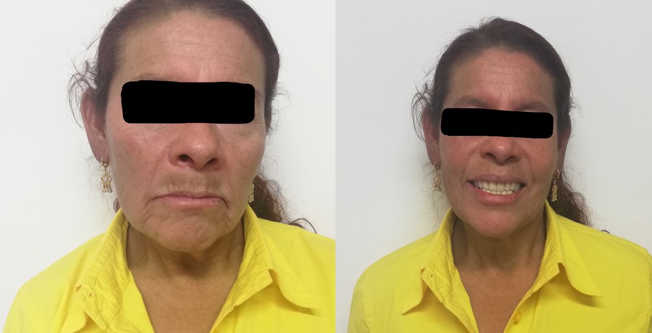 Adali Lopez Balderas-2