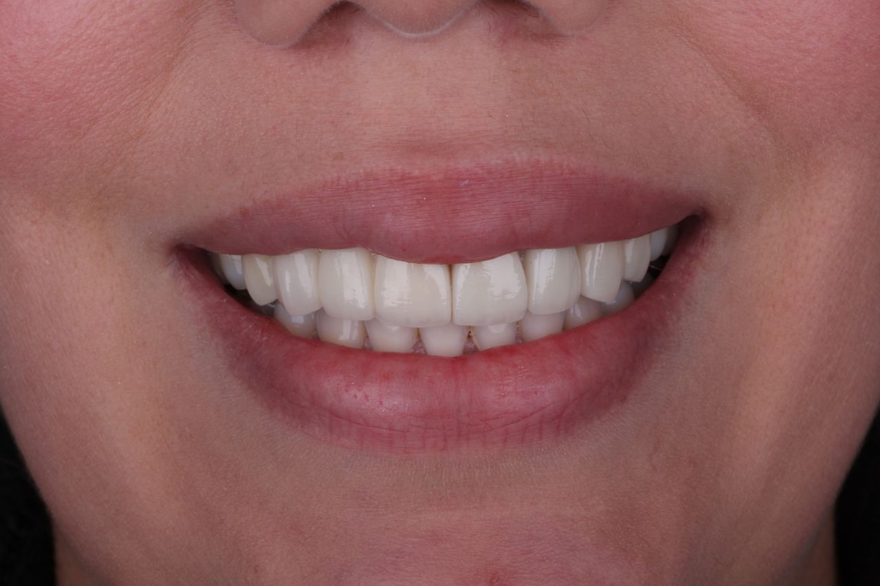 Daniel Perez Parcero-4