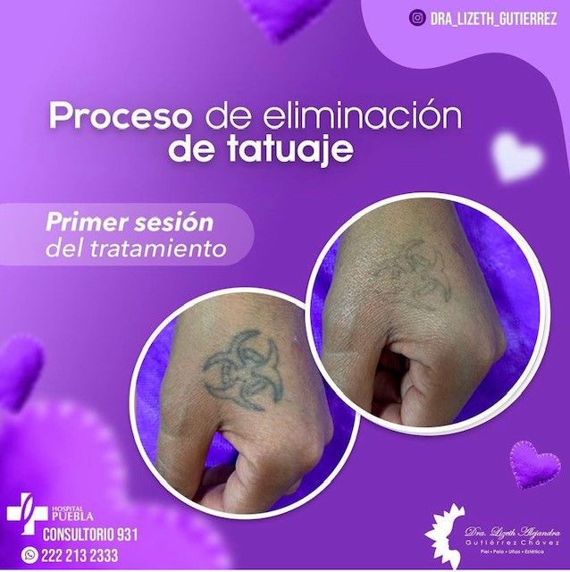 Lizeth Alejandra Gutiérrez Chavéz-11