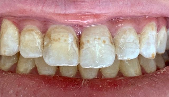 Fabián Shor Hass-10