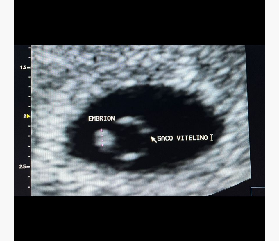 Ana Itzel Gaona Guevara-5