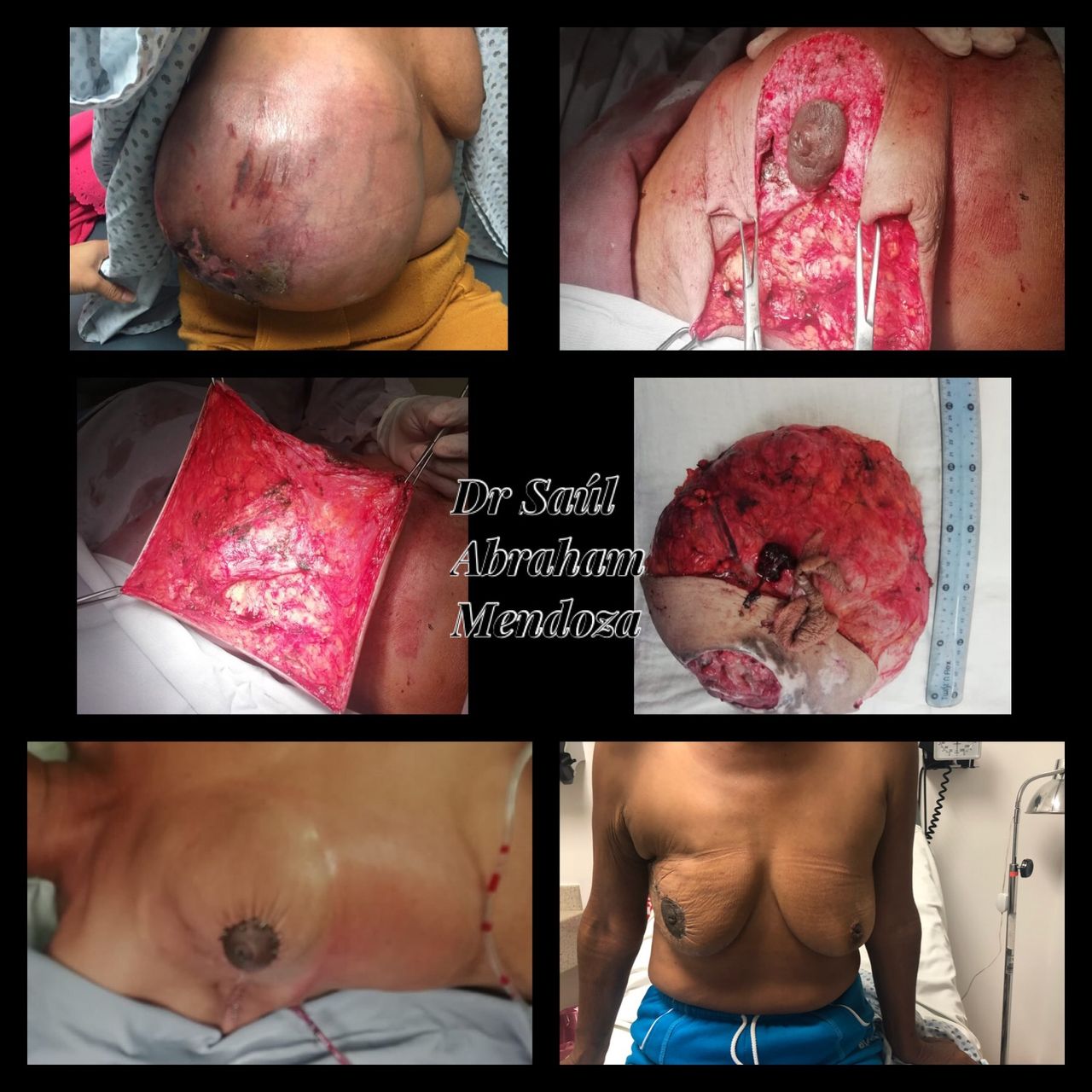 Saúl Abraham Mendoza-1