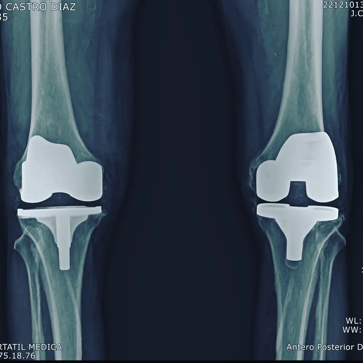 Alejandro Martínez Ramírez-23