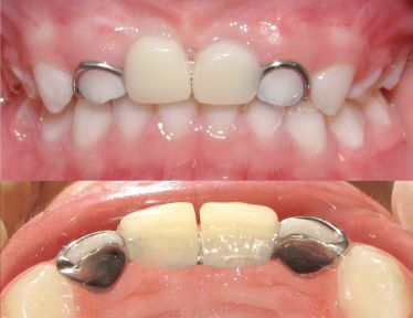 Pedro Badial Aceves-9