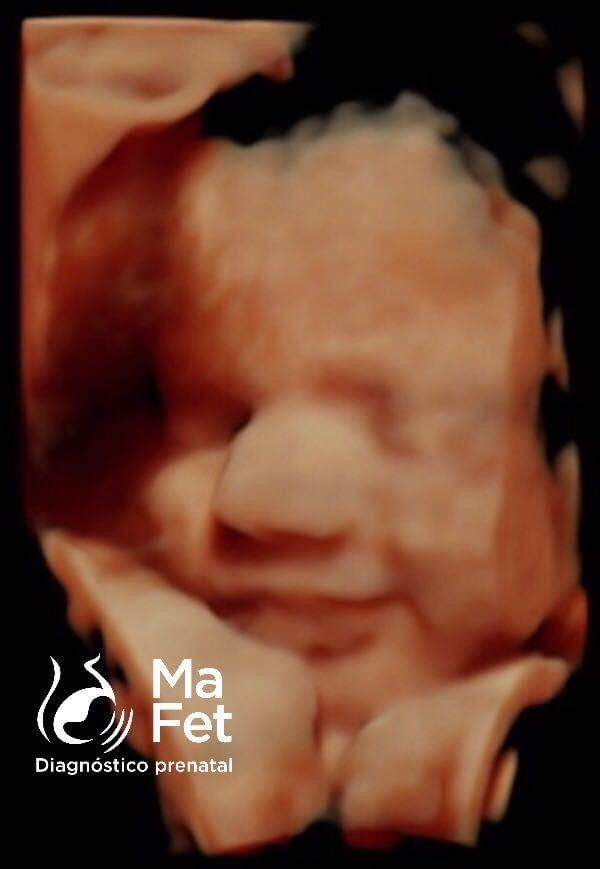 Gabriela Cabrera Lopez-22