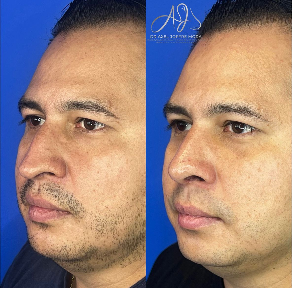 Axel Joffre Mora-81