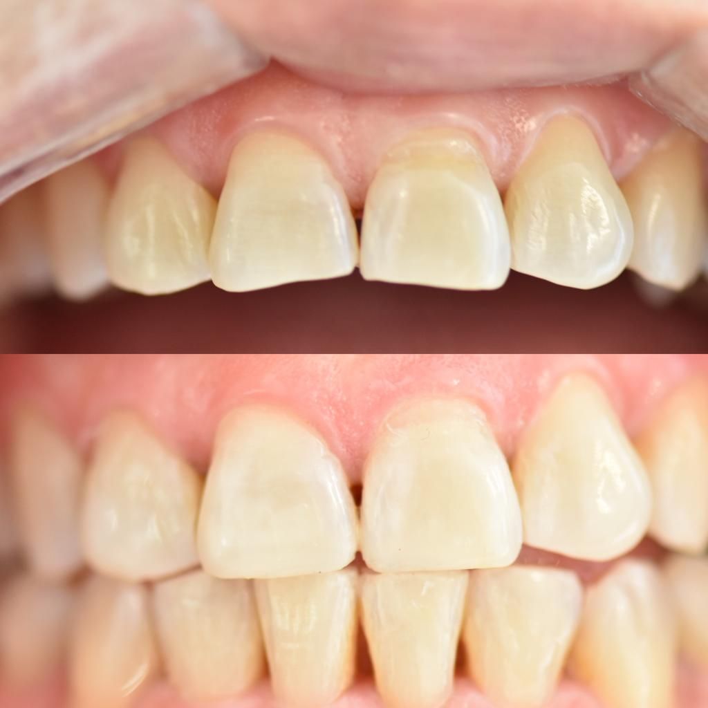 Andrea Moncada Rmz-17