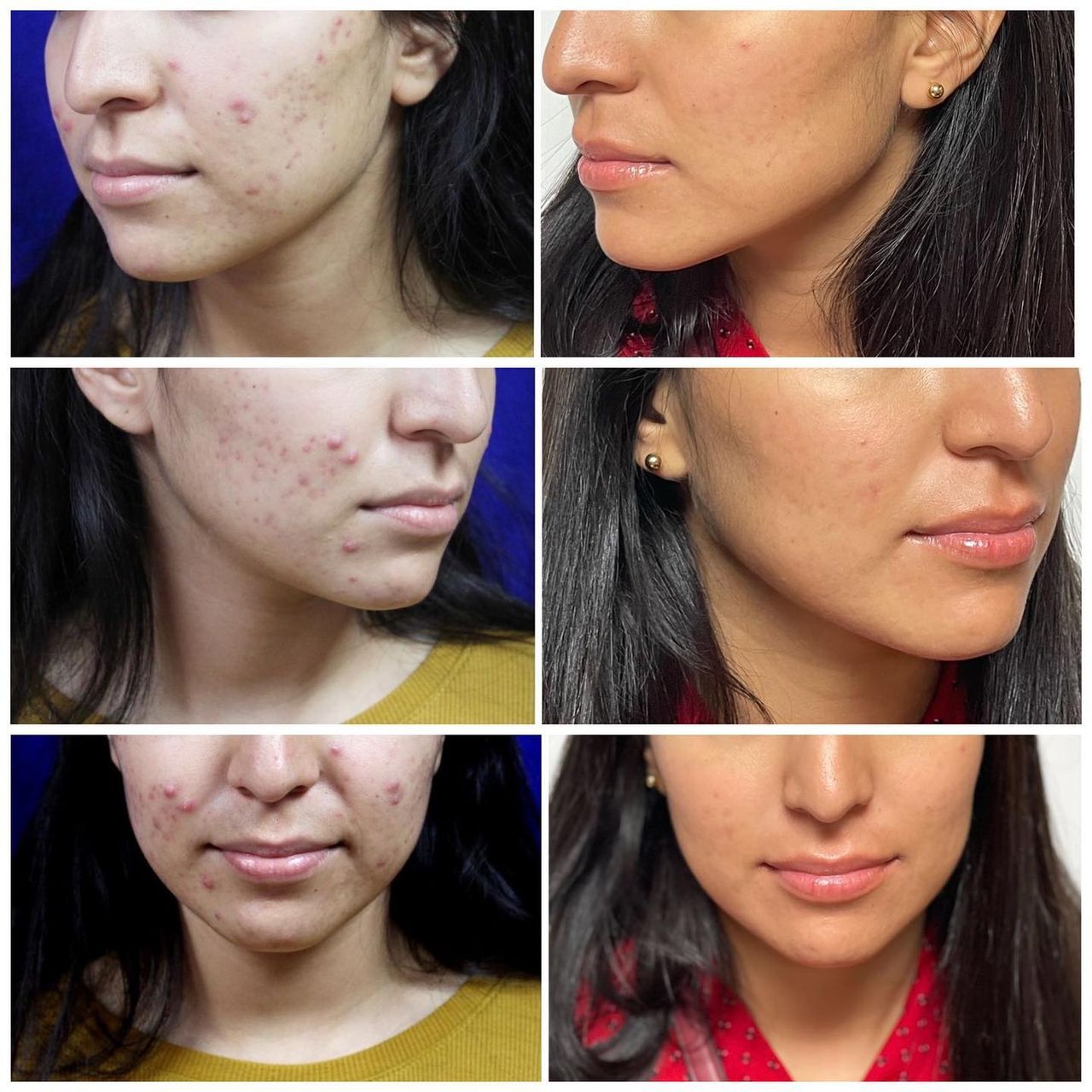 Adrián Martínez Moreno-15