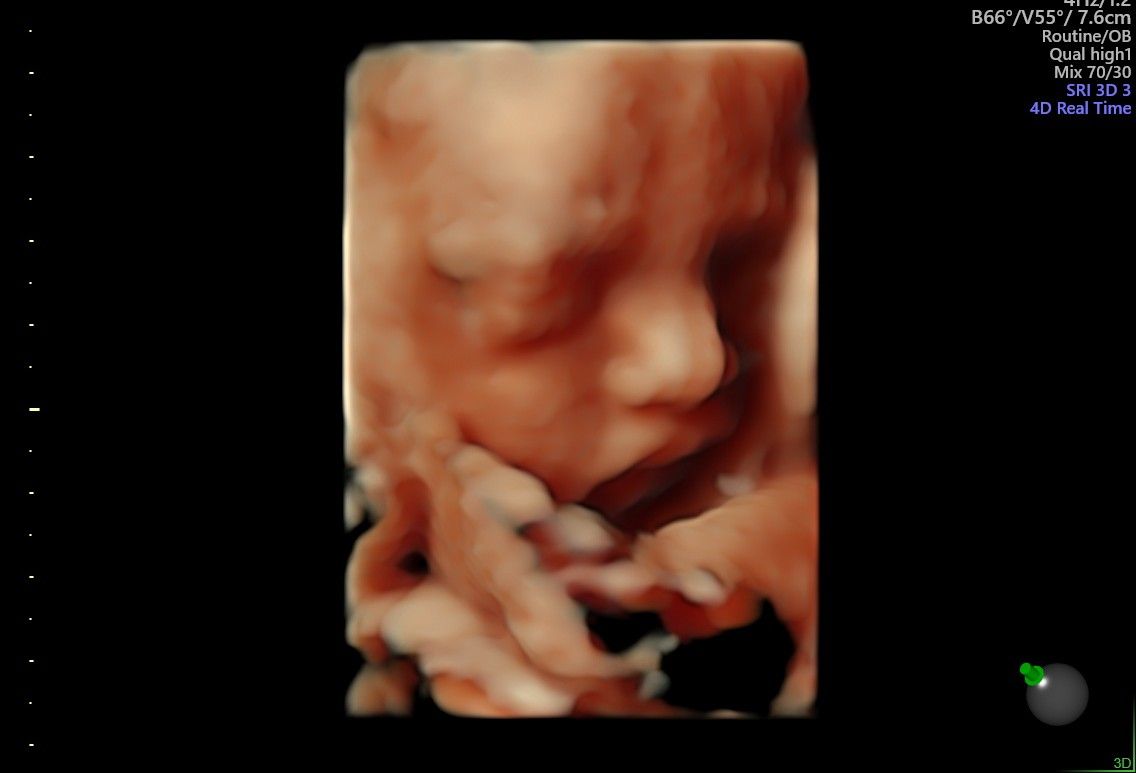 Omar Oswaldo Camarillo Contreras-6