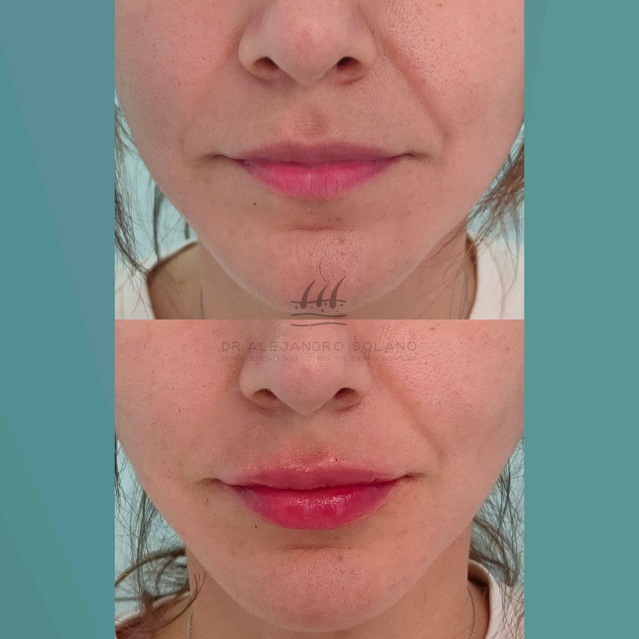 Oscar Alejandro Solano Anguiano-7