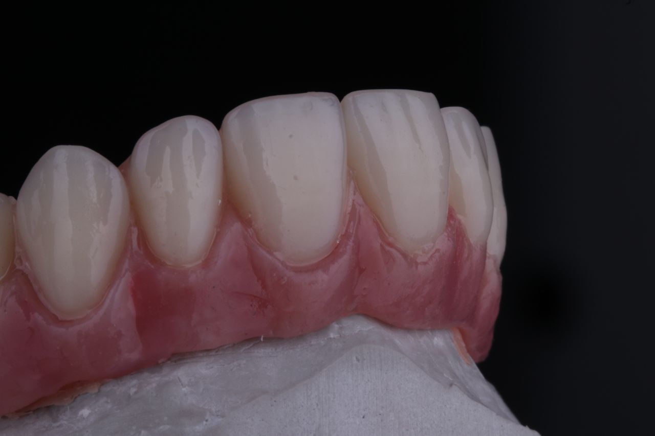 Arturo Mendez Valencia-11