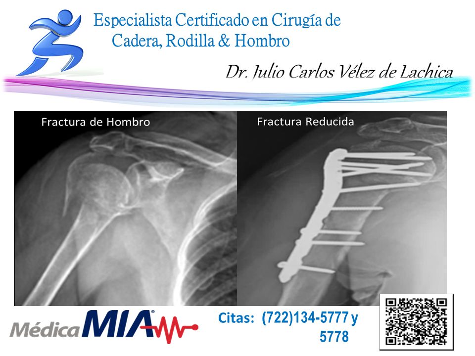 Julio Carlos Vélez De Lachica-42
