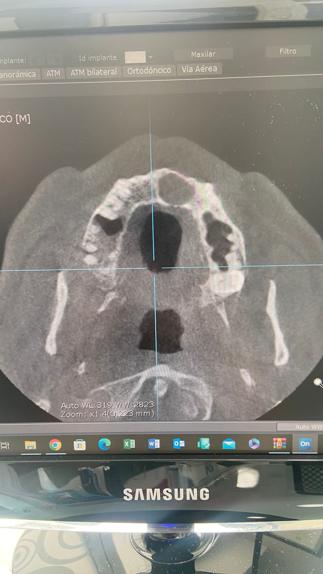 Joaquin Moguel Del Rivero-4