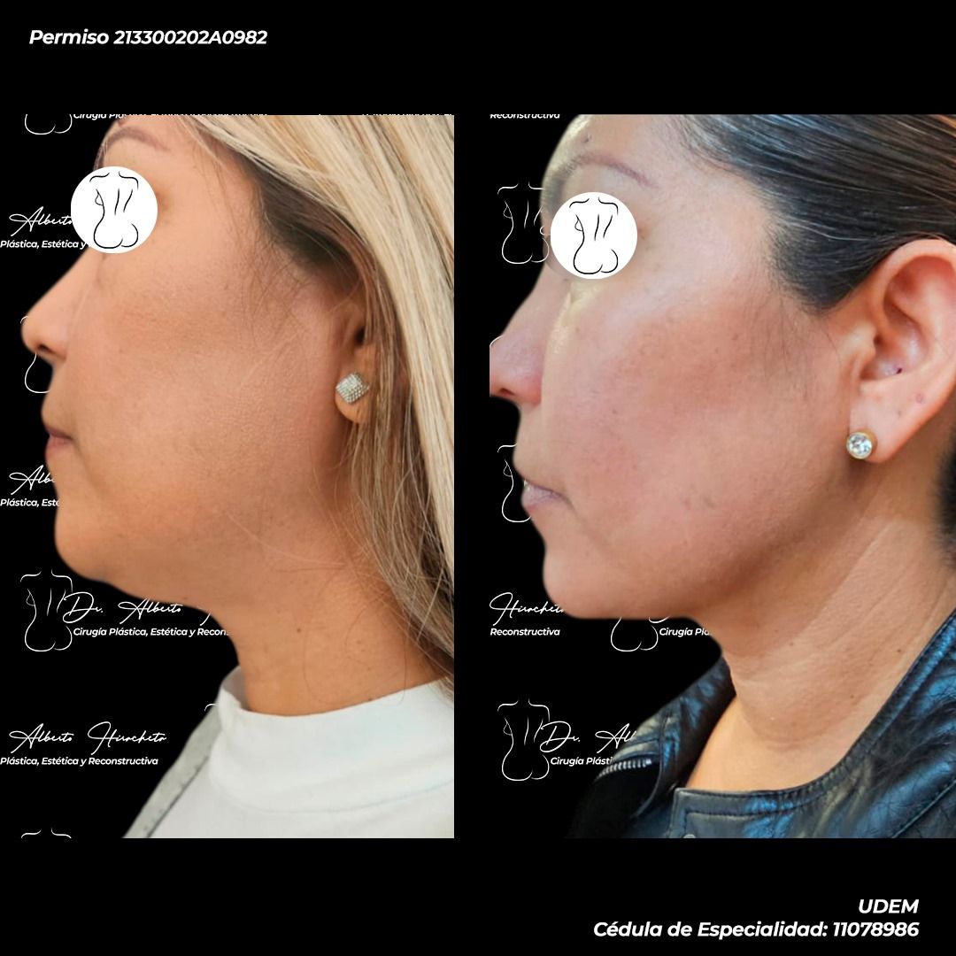 Alberto Hiracheta Torres-10