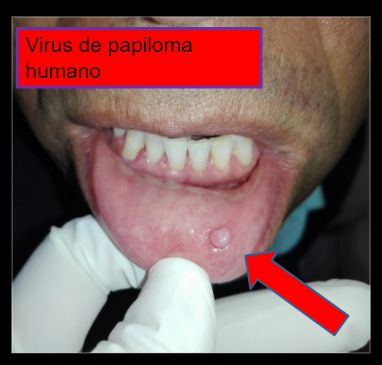 Diana Araceli Dávila Hernández-19