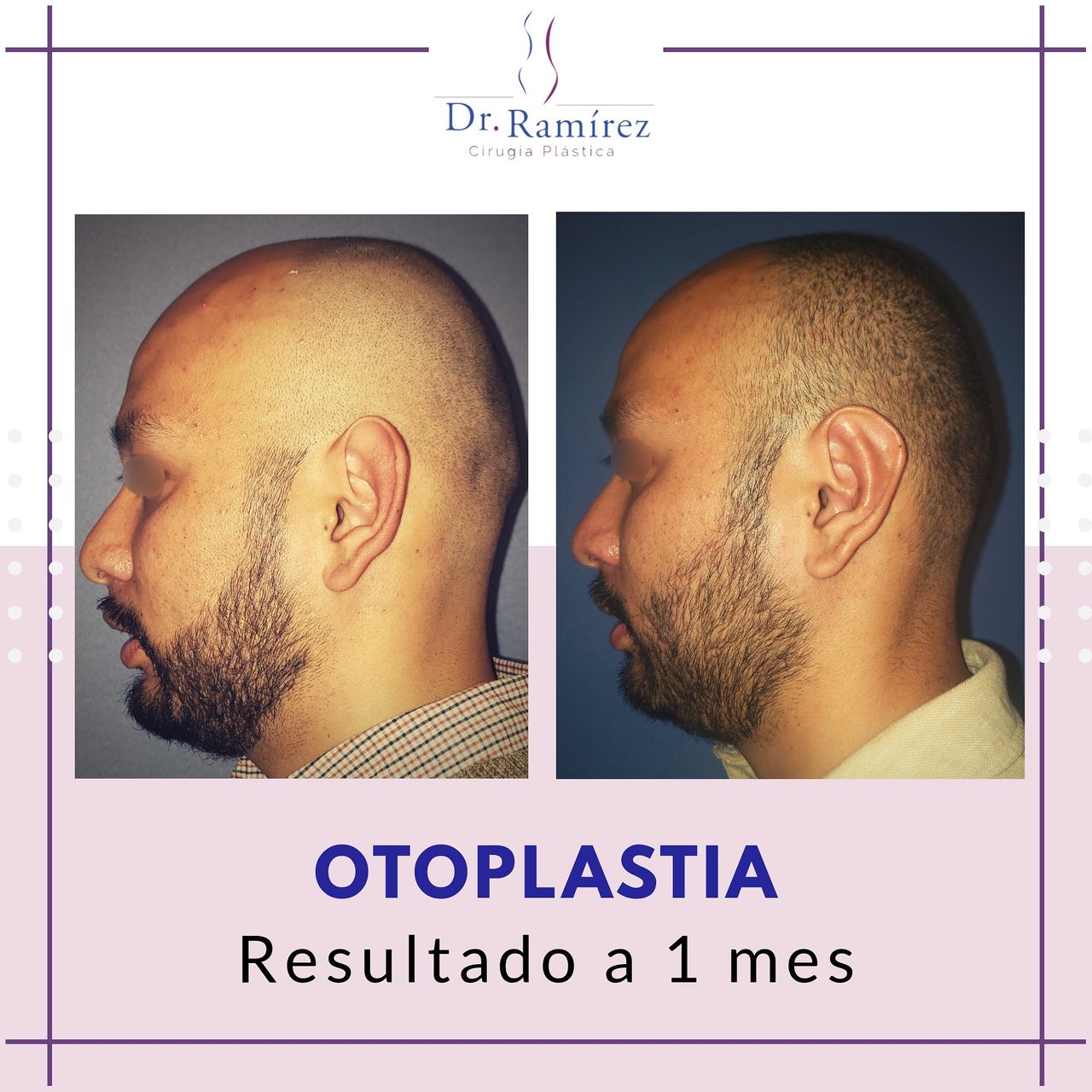Edgar Ramírez López-74