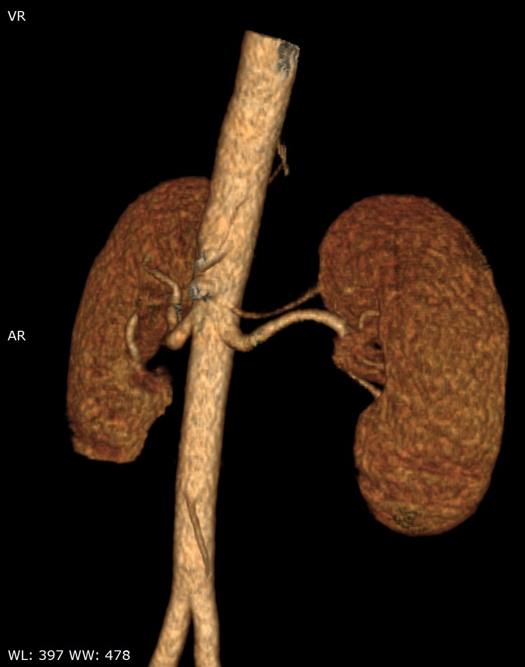 Nicolás Serrano Heredia-9