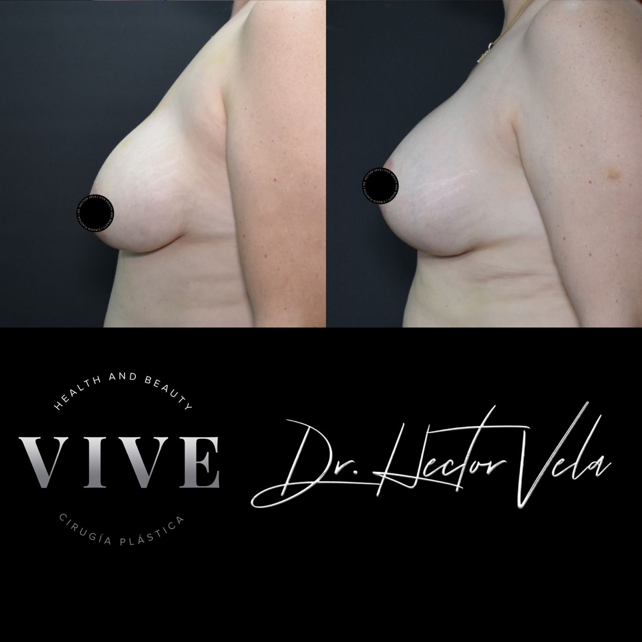 Héctor Eduardo Vela Cardona-261