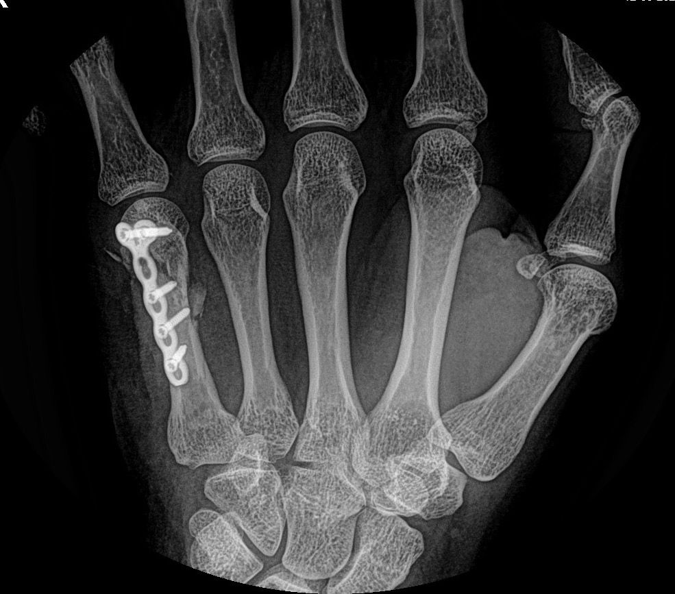 Abraham Gutiérrez Ávila-22