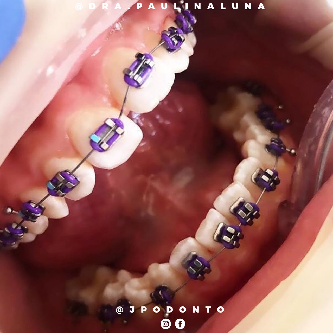 Paulina Joselin Luna Jiménez-22