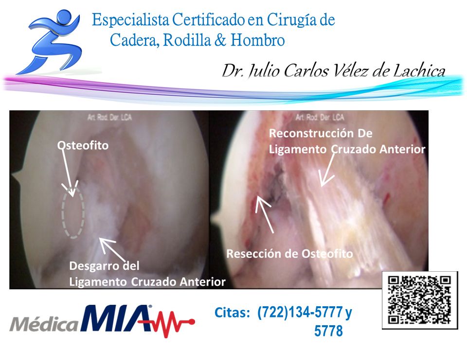 Julio Carlos Vélez De Lachica-40