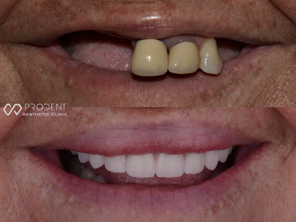 Ramiro Ivan Pérez Murillo-27