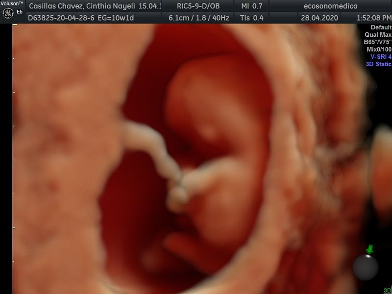 Héctor Bernardo Acevedo Manrique-1