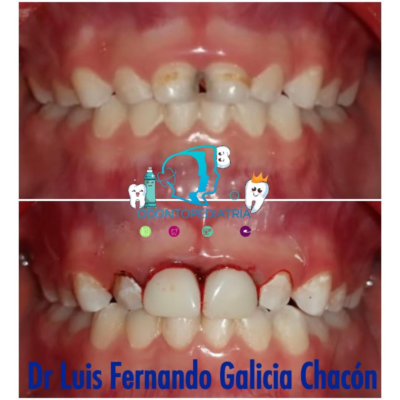 Luis Fernando Galicia Chacón-23