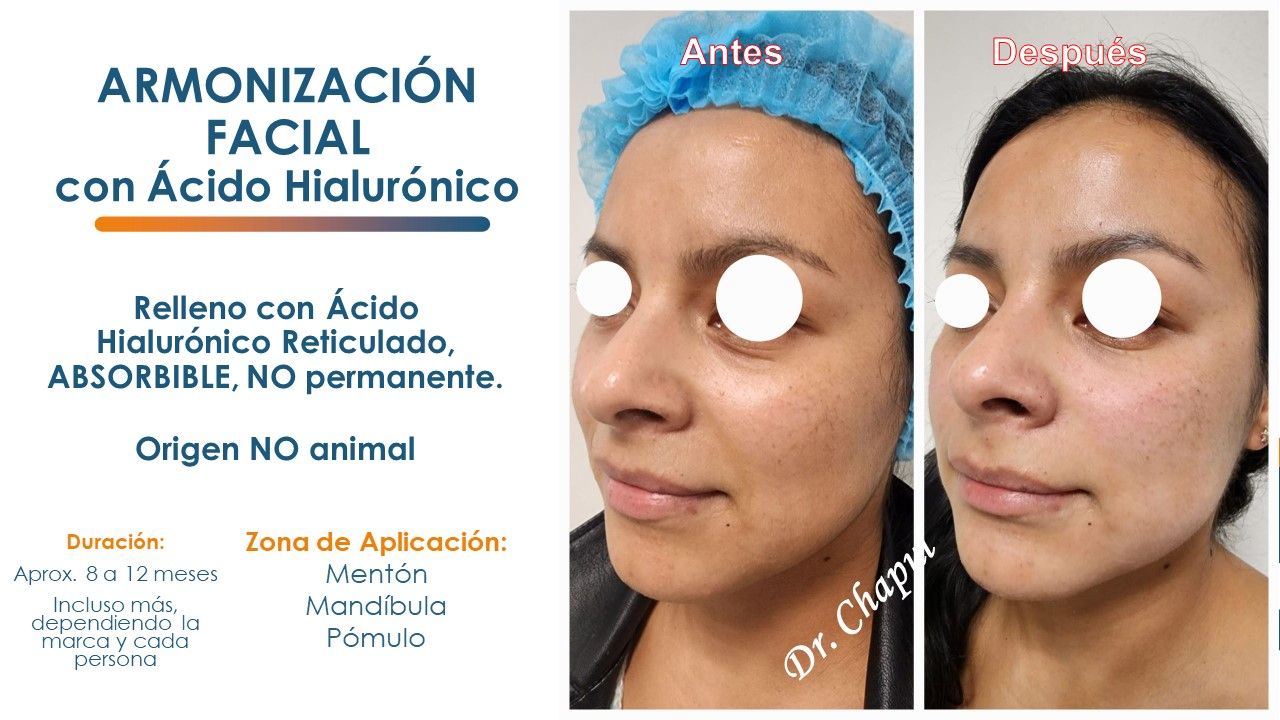 José Luis Muñoz Chapul-6