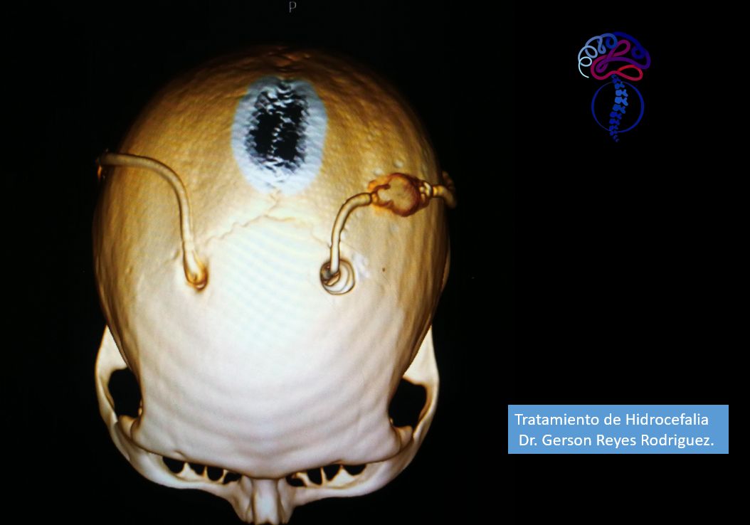 Gerson Reyes Rodríguez-60