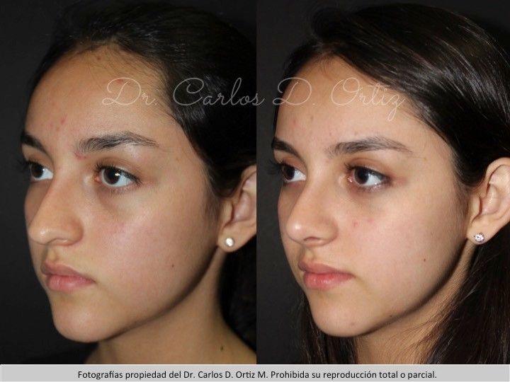 Carlos David Ortiz Moreno-51