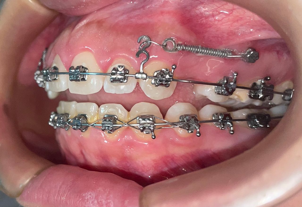 Luis Ernesto Calva Valdez-15