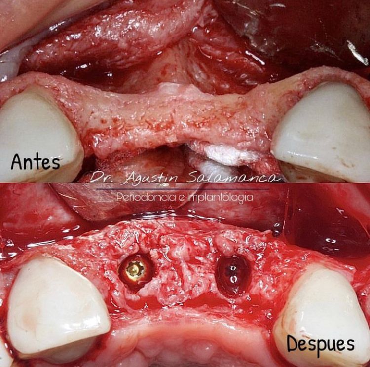 Agustin Salamanca Tapia-7
