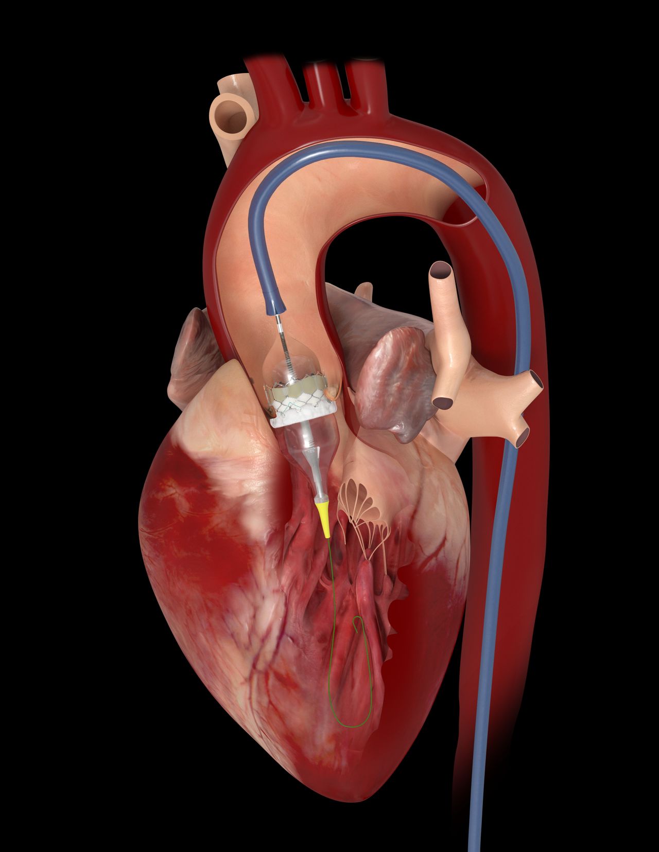 Gerardo Santiago Baca Escobar-13