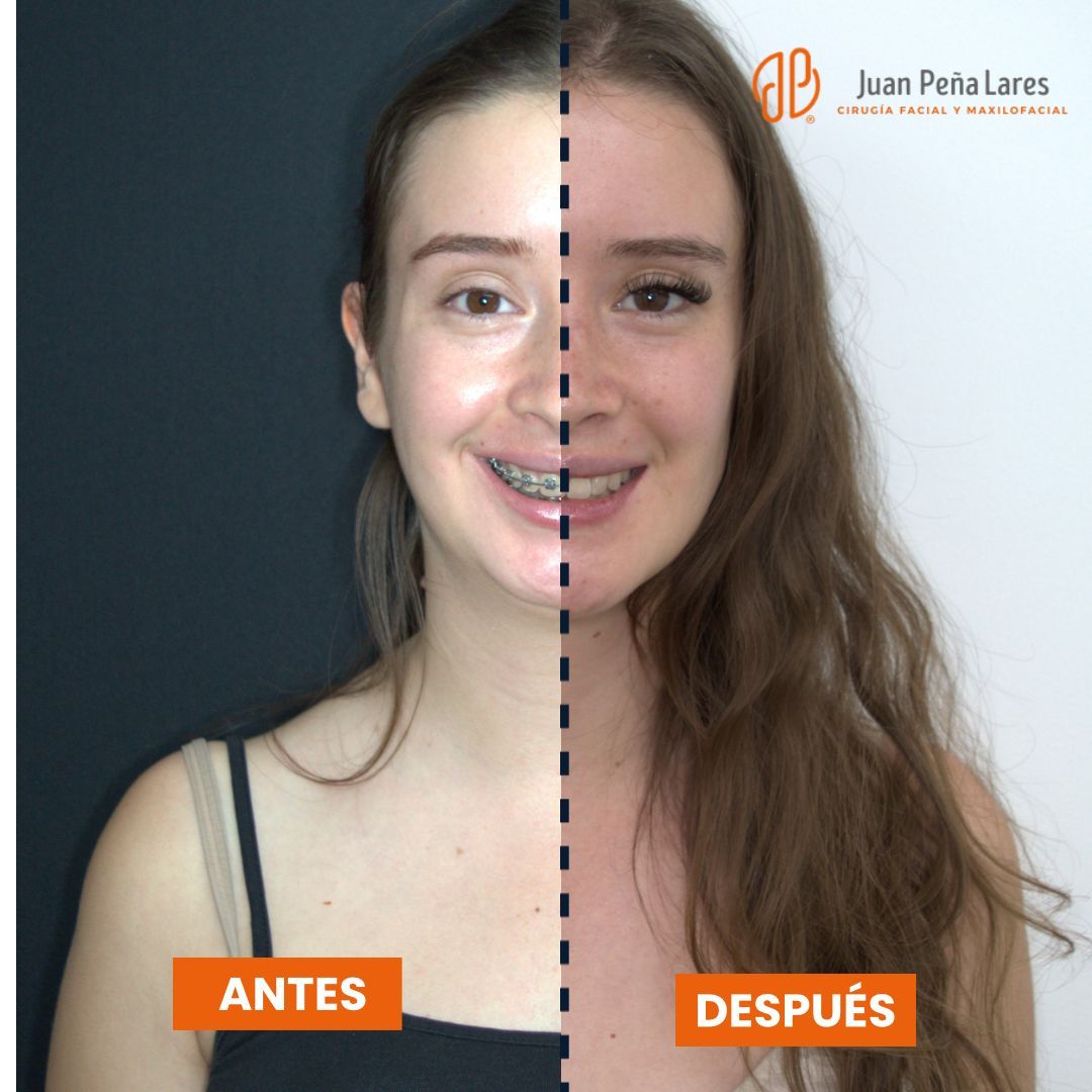 Juan Peña Lares-8