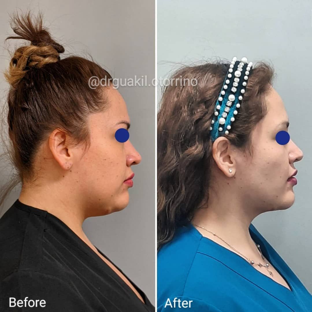 Alberto Guakil Haber-11