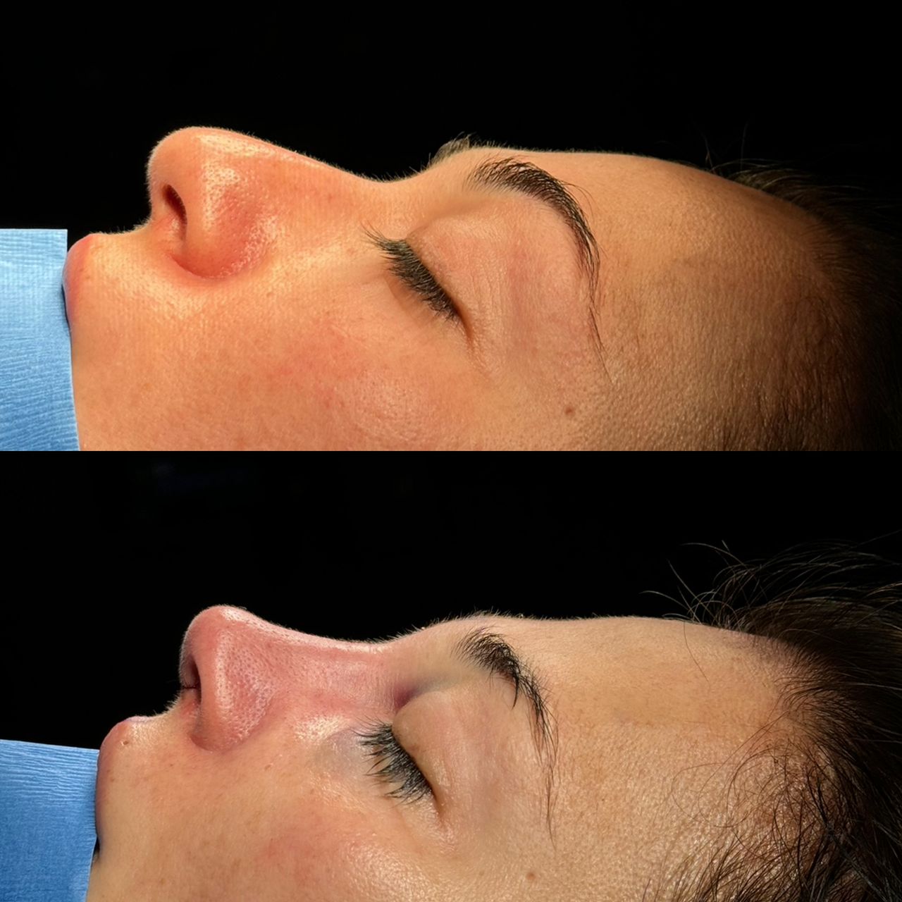 Angel Castro Urquizo-22