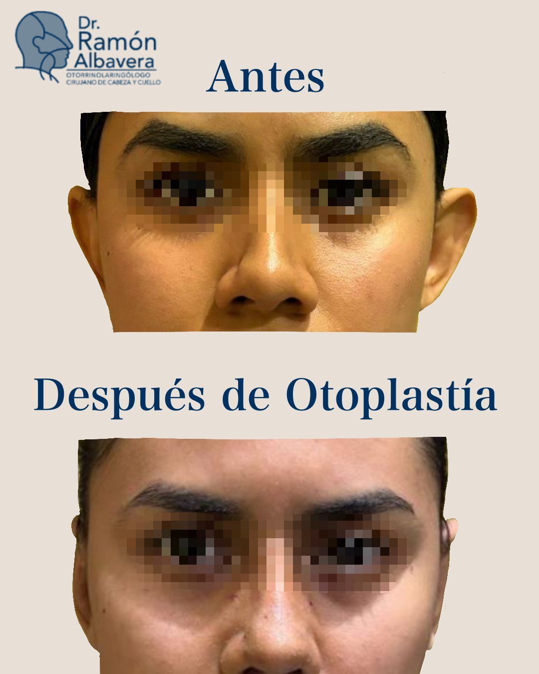 Luis Ramón Albavera Giles-6