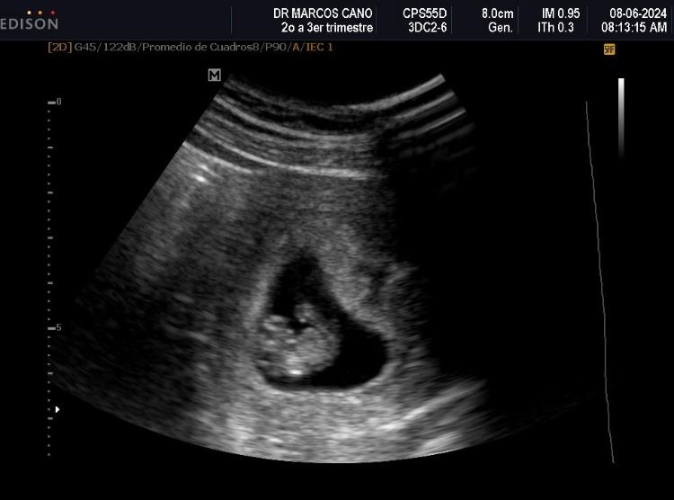 Marcos Javier Cano Luna-7